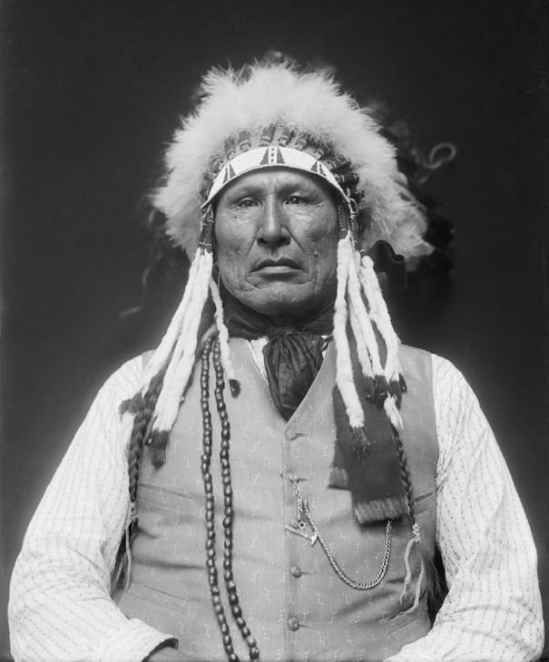 Wooden Leg in 1913